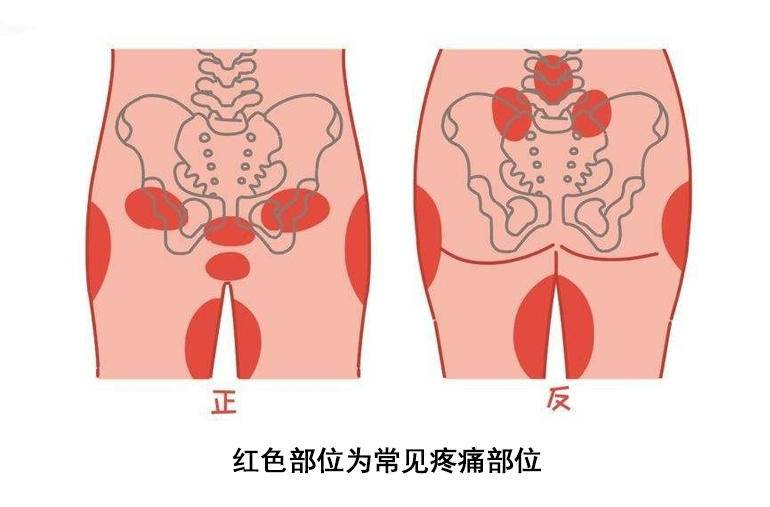 耻骨在哪个位置的图片 孕妇（耻骨在哪个位置的图片 孕妇孕中期耻骨疼）