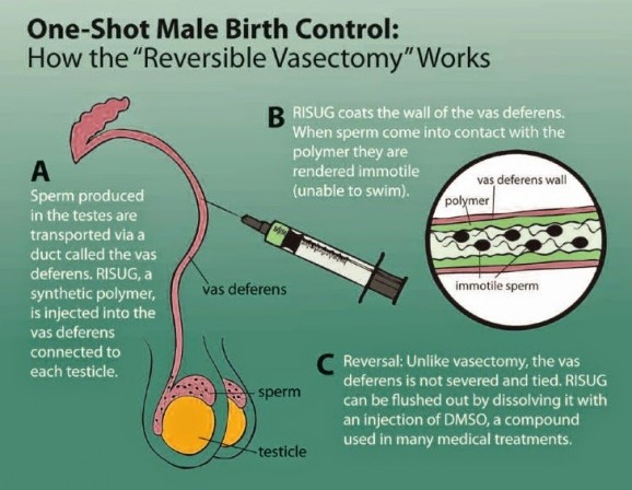 男性避孕针的危害和副作用（一年一片避孕药叫什么）