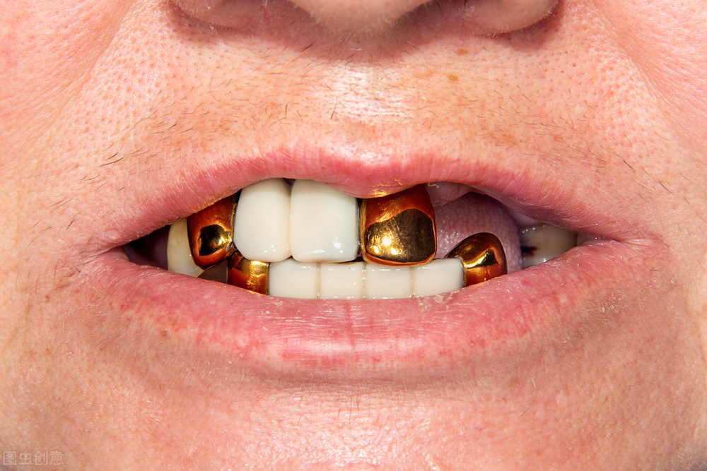 牙龈萎缩自己恢复的小妙招（保护牙龈萎缩的方法）