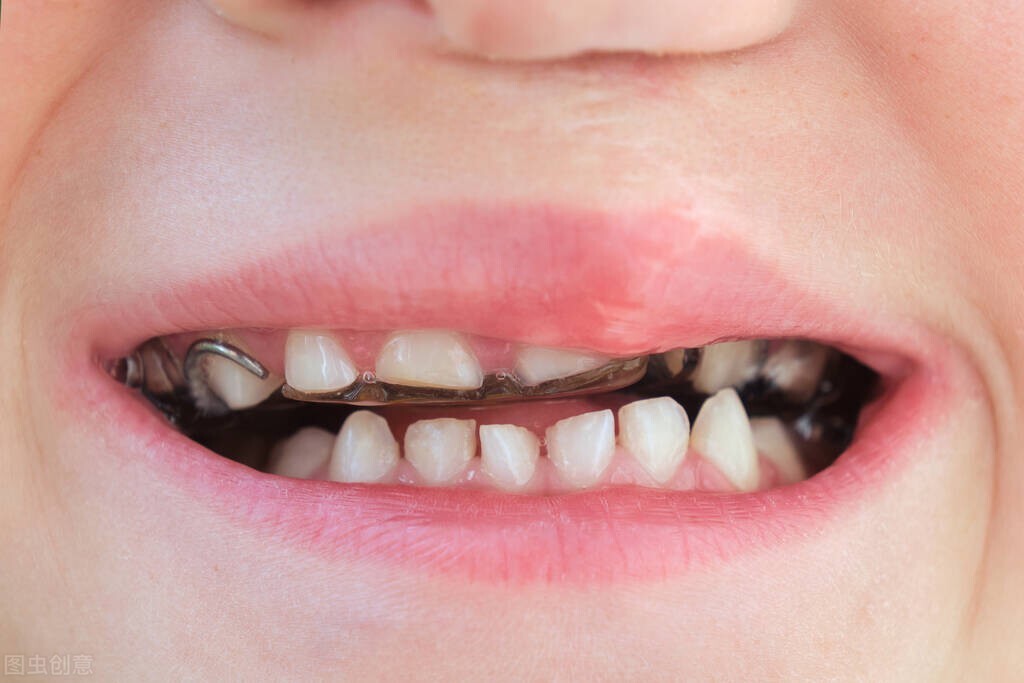 牙龈萎缩自己恢复的小妙招（保护牙龈萎缩的方法）
